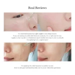 Dr. Althea Skin Relief Essence 30ml - Image 6